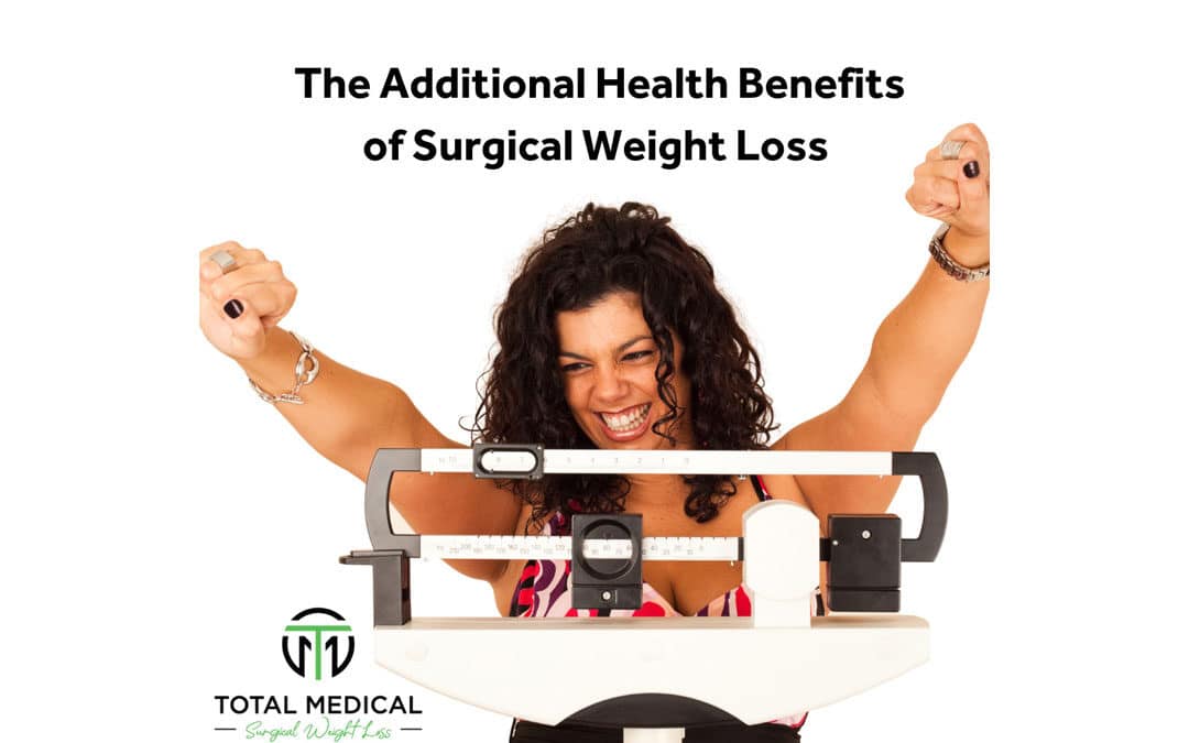 The Benefits of Weight Loss Surgery